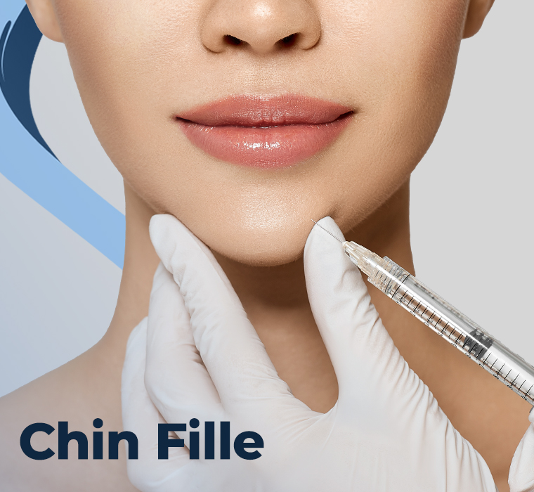 Chin Filling